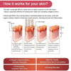 Image of Red Light Therapy Lamp - Clamp and Bulb Set - 54W 18 LED
